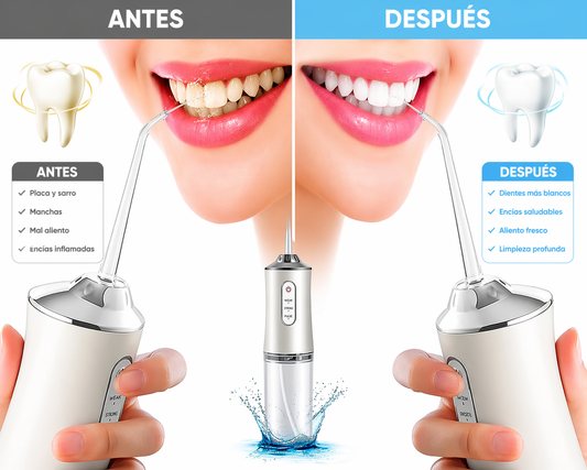 Irrigador Bucal Portátil Recargable 💦🦷✨